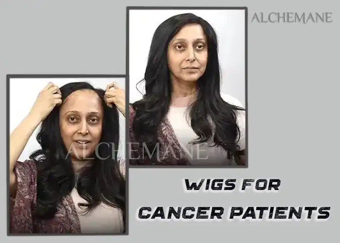 5 Things to Know About Wigs for Cancer Patients - Alchemane Hair Extensions