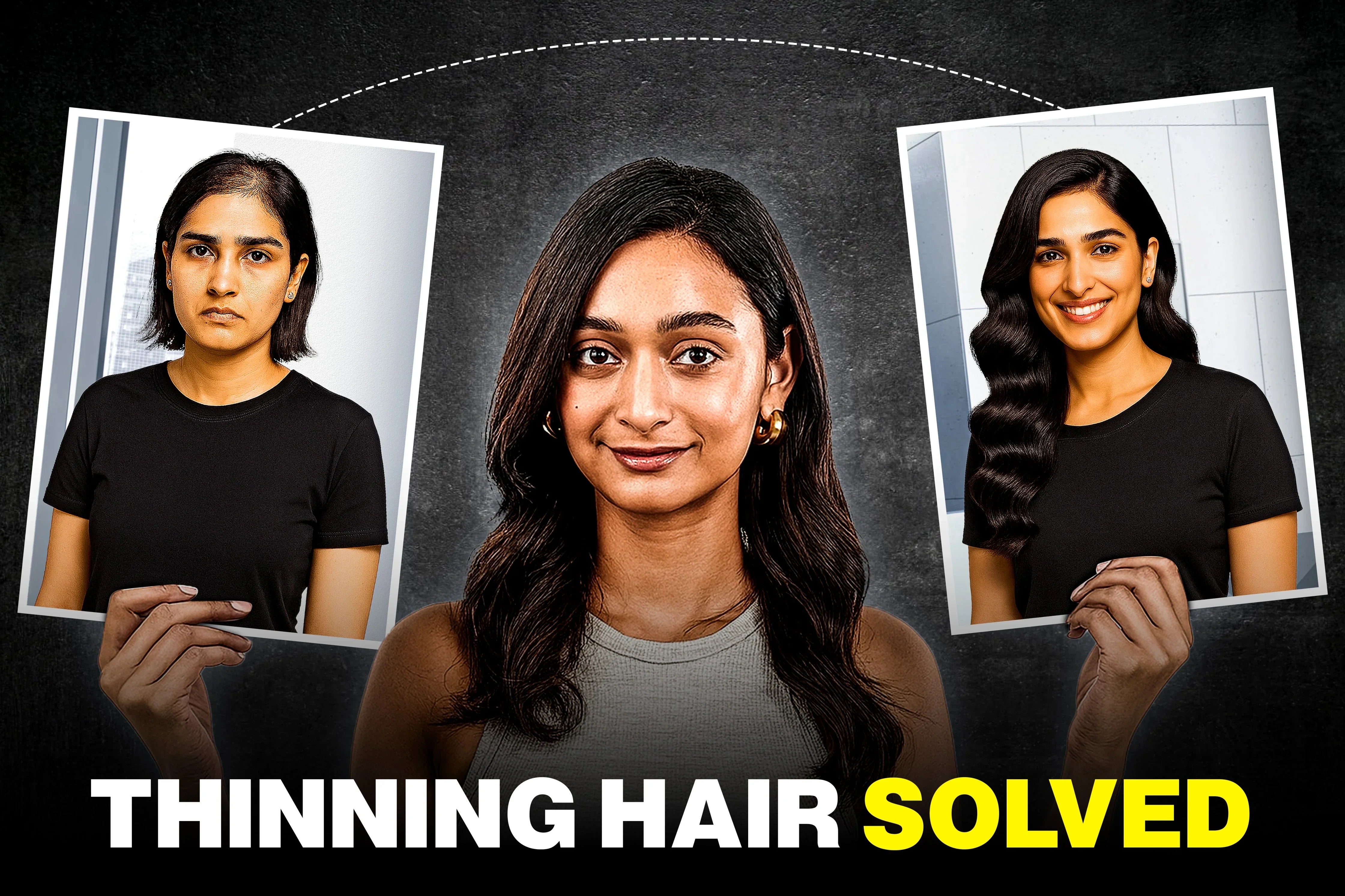 Hair Toppers vs. Extensions: What’s Best for Severe Hair Thinning?