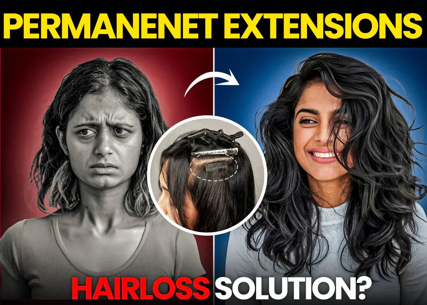 Can Permanent Hair Extensions Actually Prevent Hair Loss? Here's the Answer. - Alchemane Hair Extensions