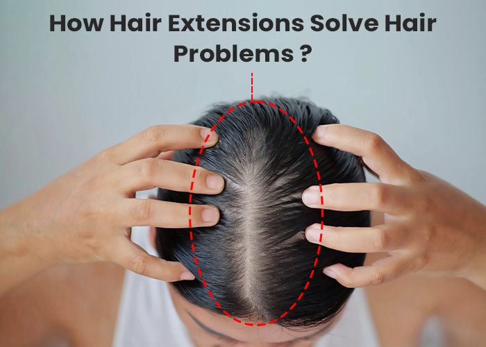 How Hair Extensions Help With Hair Problems - Alchemane Hair Extensions