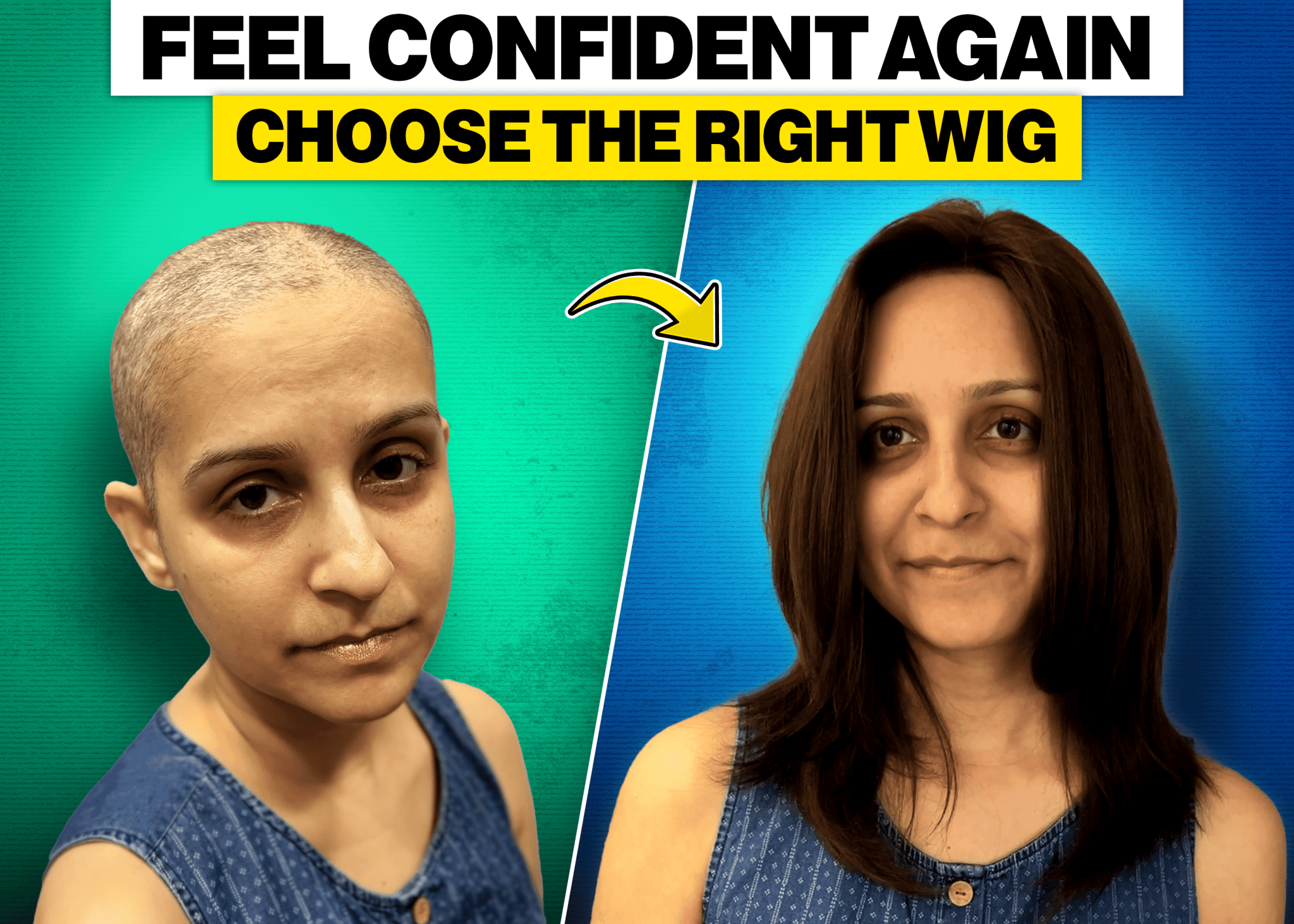 How to Choose a Cancer Wig That Feels Like Your Own Hair - Alchemane Hair Extensions