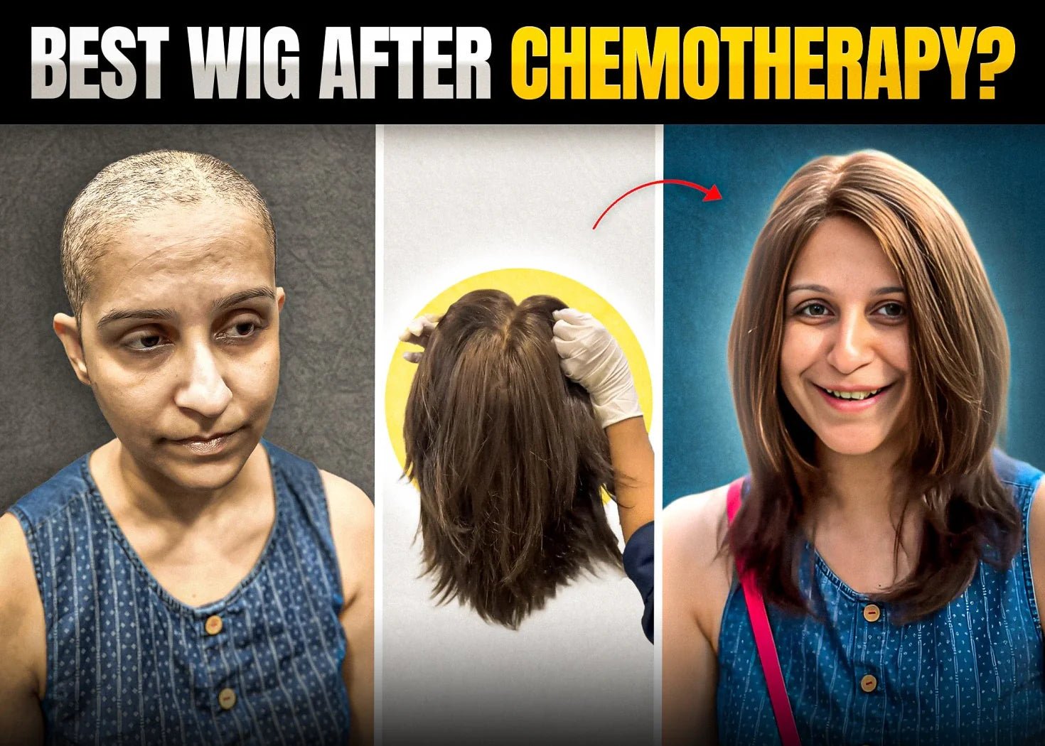 How to Choose the Perfect Wig for Your Cancer Recovery Journey - Alchemane Hair Extensions