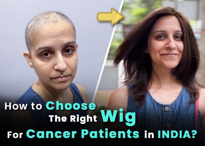 How to Choose the right Wig for Cancer Patient in India - Alchemane Hair Extensions