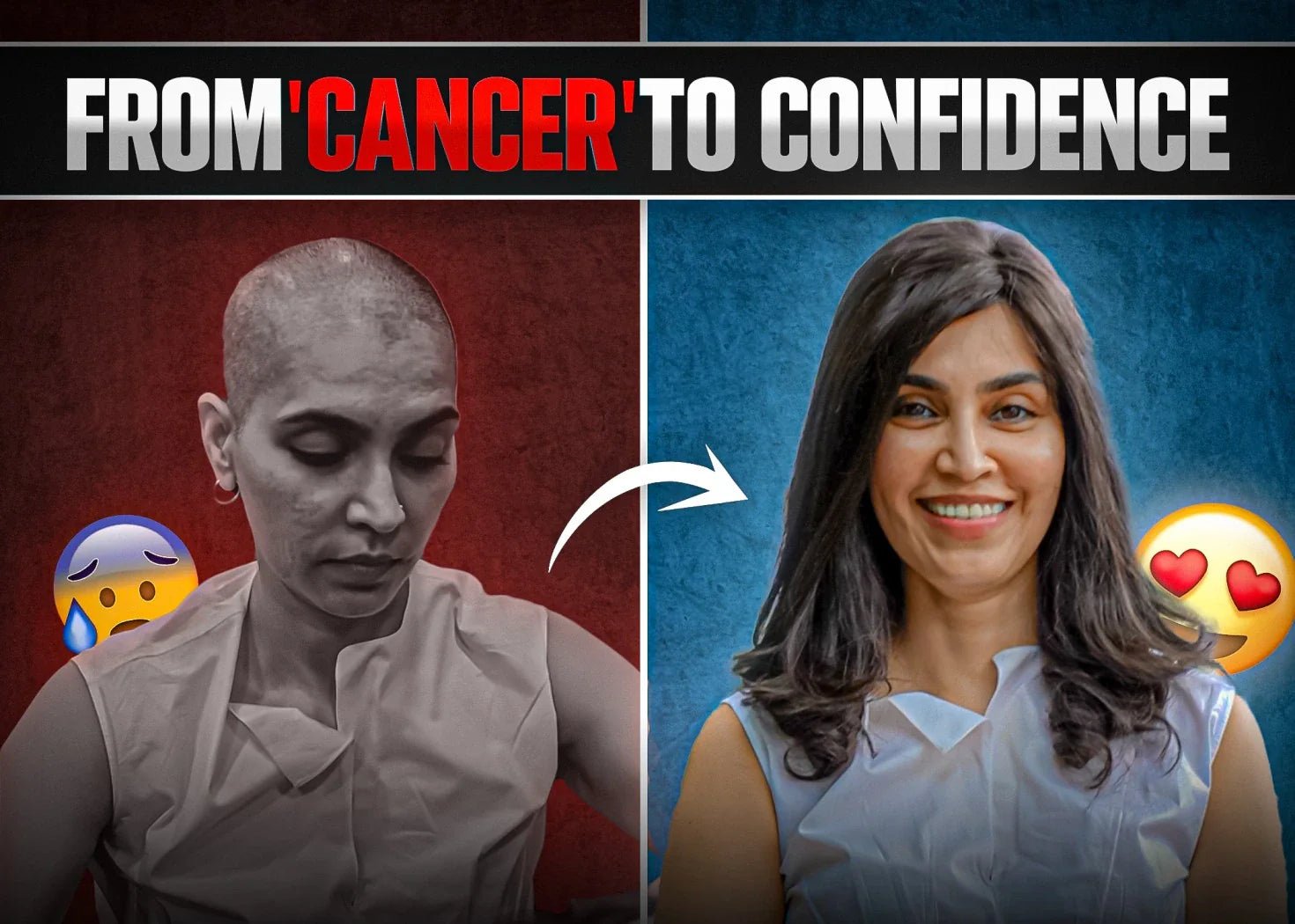 How to Navigate Hair Loss During Cancer Treatment with Style - Alchemane Hair Extensions