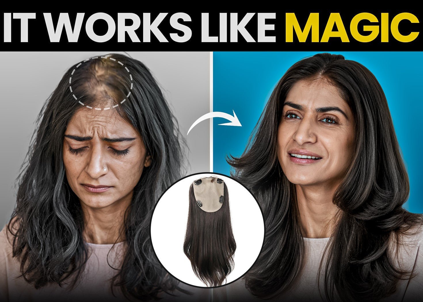 I Thought My Hair Loss Was Hopeless Until I Discovered This! - Alchemane Hair Extensions