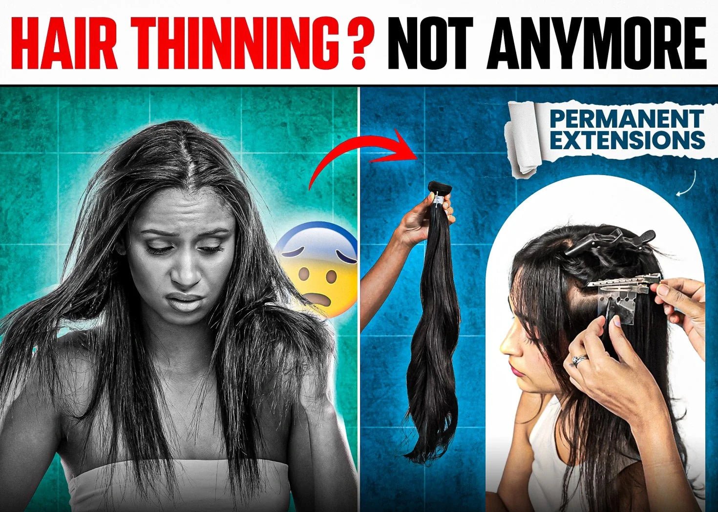 Thinning Hair Worries? Here’s Why Permanent Extensions Are the Solution - Alchemane Hair Extensions