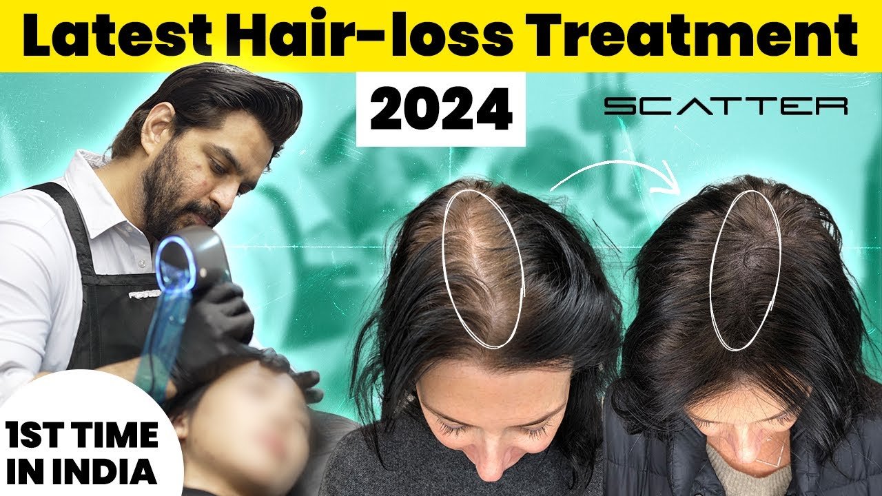 What They Don’t Tell You About Robotic Scalp Micropigmentation - Alchemane Hair Extensions