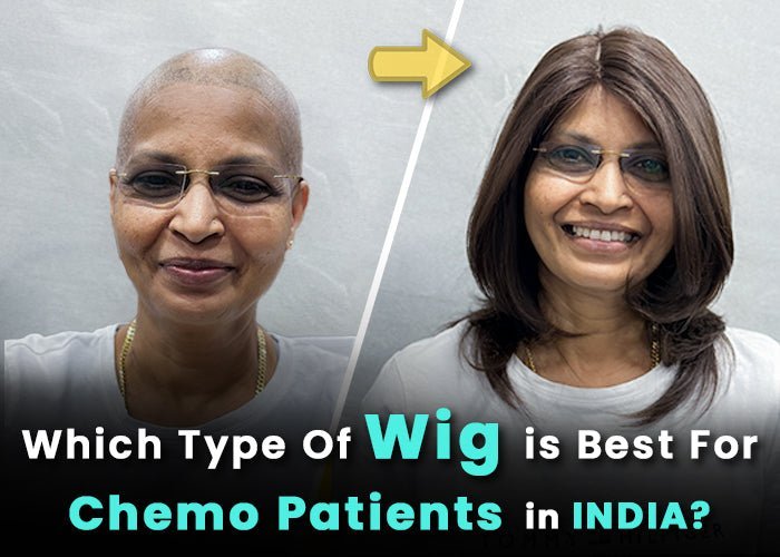 What Type of Wig is best for Chemotherapy patients in India? - Alchemane Hair Extensions