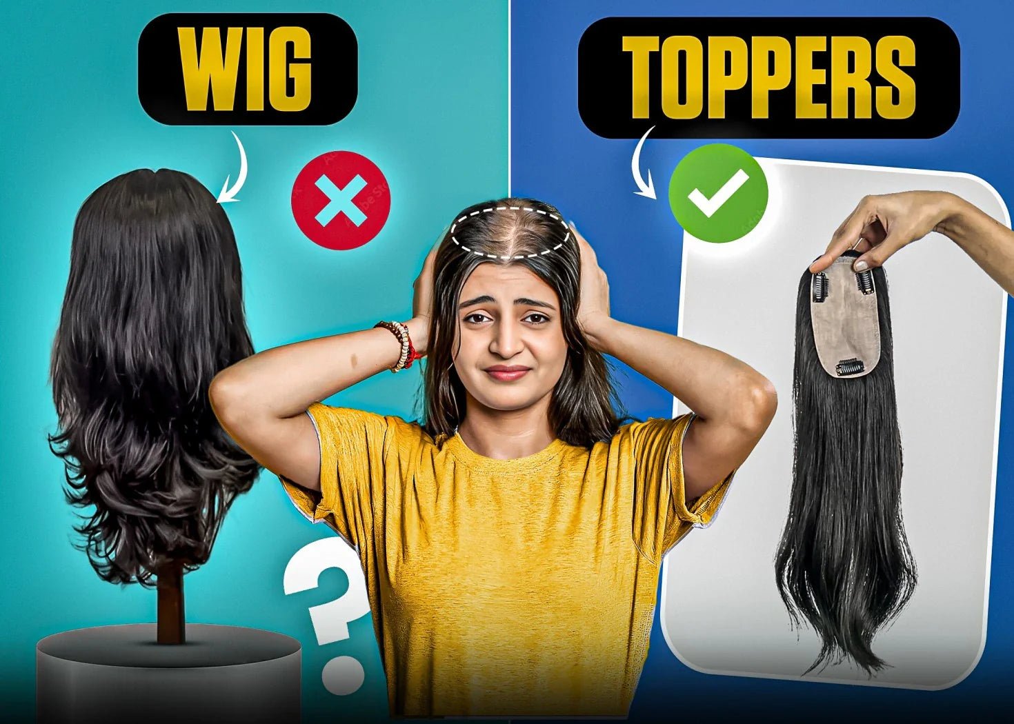 Wigs vs. Toppers: The Ultimate Confidence Boost for Thinning Hair - Alchemane Hair Extensions