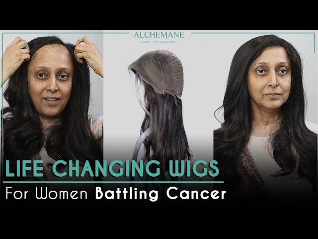 "A powerful visual showcasing life-changing wigs for women battling cancer. The image features a woman before and after wearing a natural-looking wig, highlighting the transformation. The center image displays the wig's inner construction, emphasizing quality and comfort. The text 'Life-Changing Wigs for Women Battling Cancer' reinforces the emotional impact of the product."