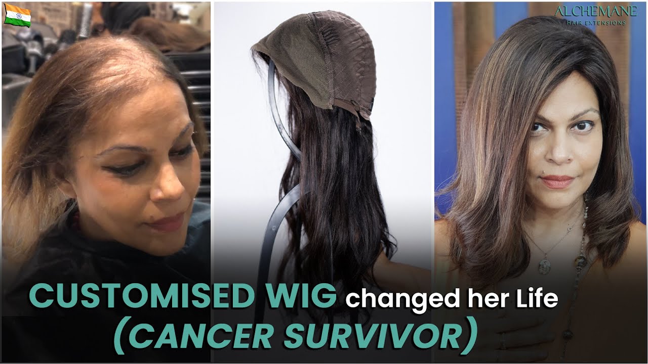 "Three-step visual representation of concerns when ordering a wig: (1) A woman experiencing severe hair thinning, (2) A close-up of a wig cap structure, and (3) A woman confidently wearing a natural-looking wig. The image addresses common doubts about wig selection and results."