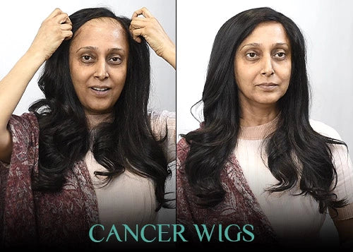 Cancer Wigs: Planning in Advance.